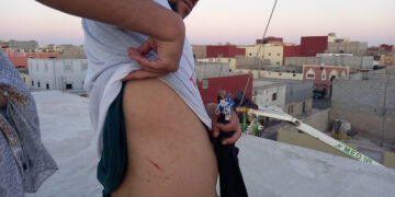 هجوم عنيف وسافر يستهدف منزل عائلة أهل خيا ببوجدور المحتلة ومن فيه من المتضامنين ( + التفاصيل) .