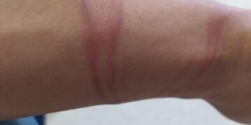 وزارة شؤون الأرض المحتلة والجاليات تدين تصاعد وتيرة جرائم الاحتلال المغربي في حق المدنيين الصحراويين المطالبين بالحرية.