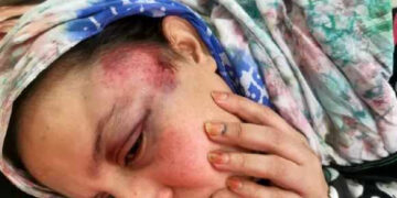 بالفيديو : الجسورة سلطانة خيا وشقيقتها تؤكدان تعرضهما للإغتصاب بعصا في هجوم مخزني جديد.