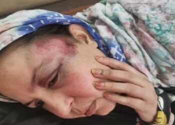 نجاة الرمز الوطني سلطانة خيا من محاولة إغتيال فاشلة بمدينة بوجدور
